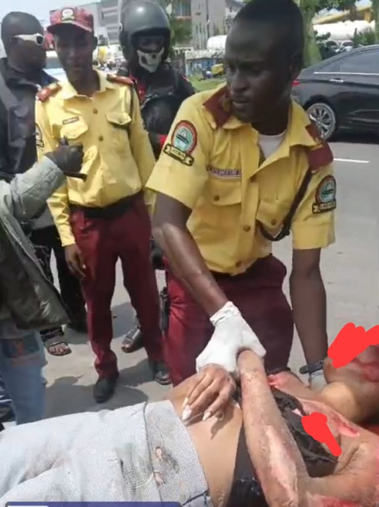 LEKKI-EPE EXPRESSWAY: LASTMA RESCUES FEMALE HIT-AND-RUN VICTIM SUFFERING FRACTURED ARM, LEG, FACILITATES PROMPT EMERGENCY EVACUATION
